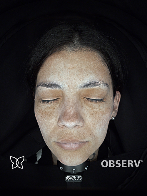 Clinica DAS scanner facial OBSERV