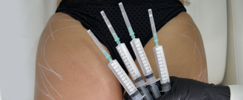 lanluma gluteos clínica das
